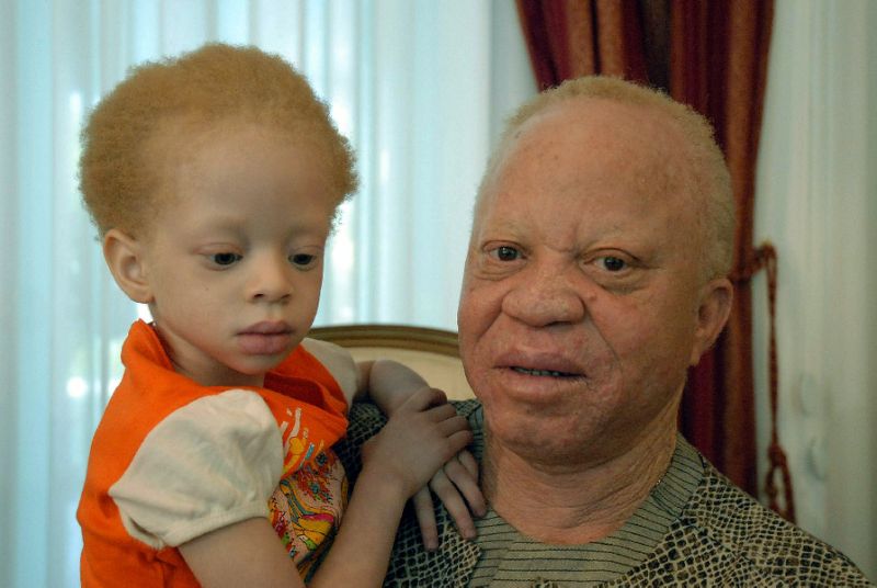 5-year-old girl with albinism Djeneba Diarra beheaded in suspected ritual murder in Mali