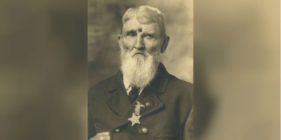 America Civil War: Soldier Shot in the Head Survived for Decades